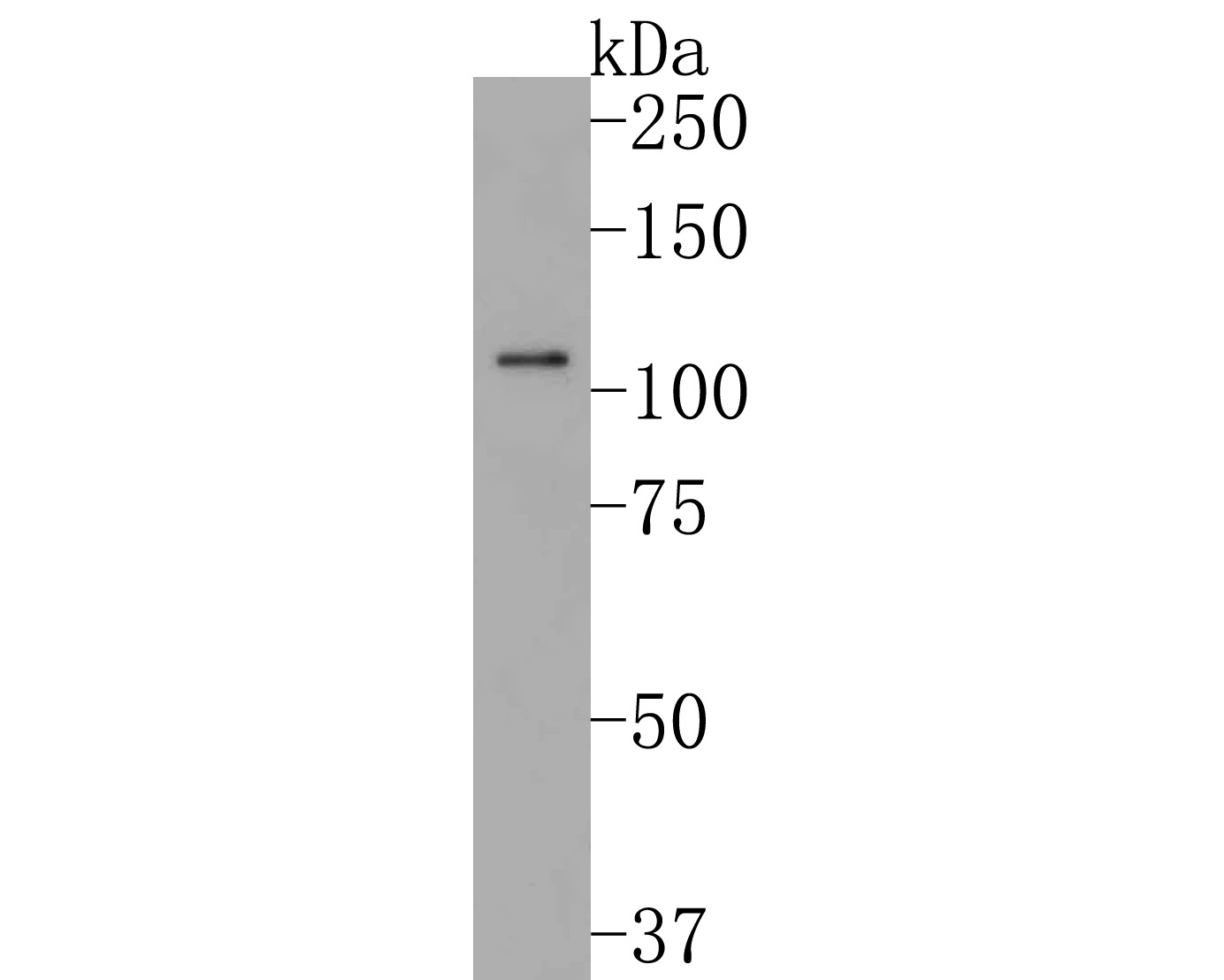 Western blot analysis of Sall4 on CAL-62 cell lysates. Proteins were transferred to a PVDF membrane and blocked with 5% NFDM/TBST for 1 hour at room temperature. The primary antibody (HA500482, 1/1,000) was used in 5% NFDM/TBST at room temperature for 2 hours. Goat Anti-Rabbit IgG - HRP Secondary Antibody (HA1001) at 1:200,000 dilution was used for 1 hour at room temperature.