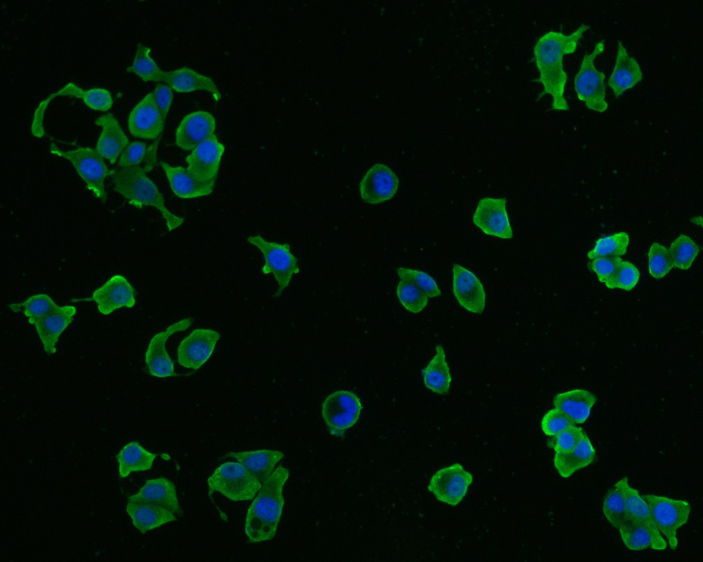 CX3CR1 Mouse Monoclonal Antibody [A5C7] (HA600074) – HUABIO