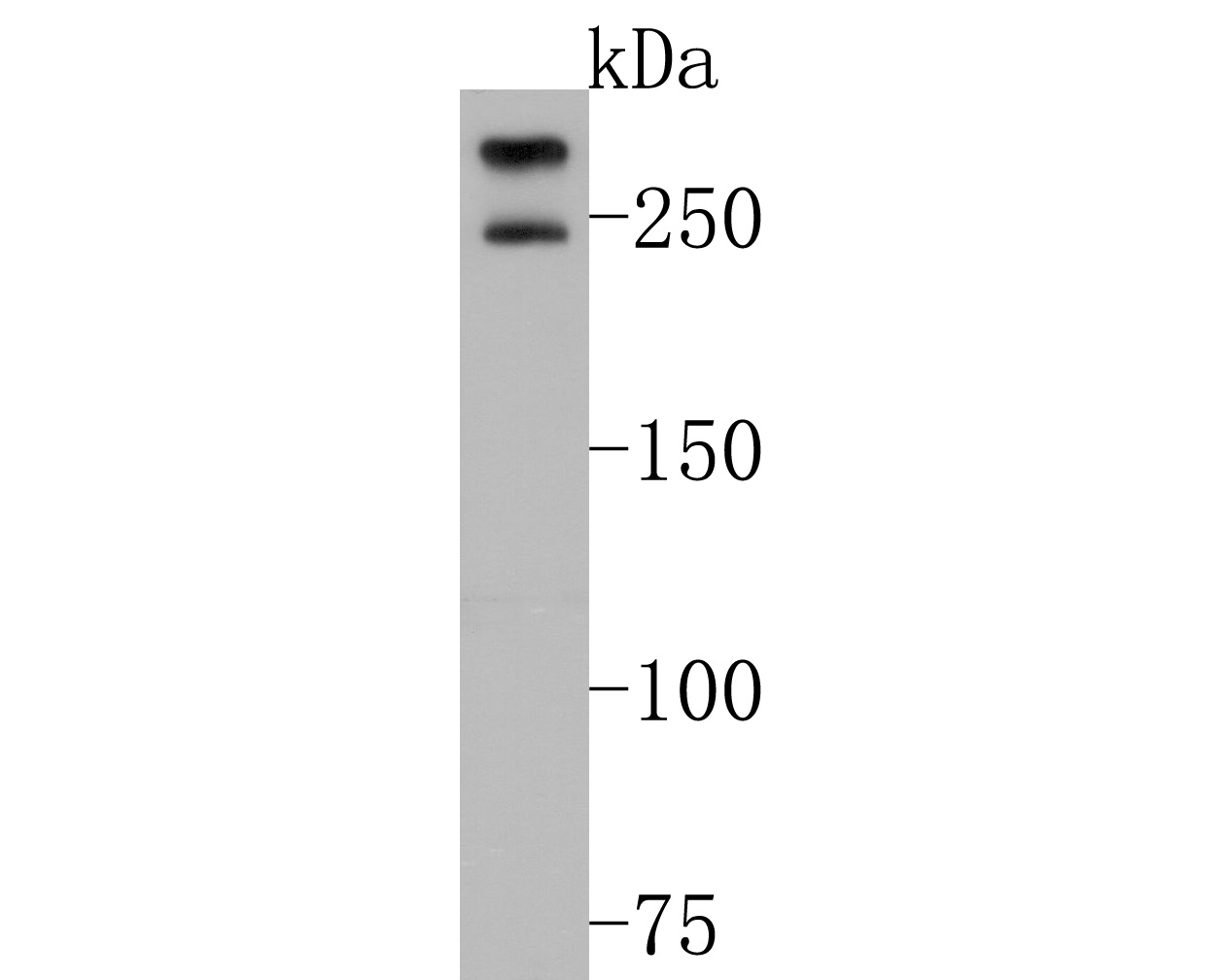 Western blot analysis of POLR2A on MCF-7 cell lysates. Proteins were transferred to a PVDF membrane and blocked with 5% NFDM/TBST for 1 hour at room temperature. The primary antibody (HA600062, 1/500) was used in 5% NFDM/TBST at room temperature for 2 hours. Goat Anti-Mouse IgG - HRP Secondary Antibody (HA1006) at 1:20,000 dilution was used for 1 hour at room temperature.