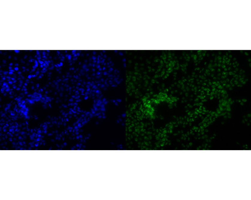 ICC staining of POLR2A in Hela cells (green). Formalin fixed cells were permeabilized with 0.1% Triton X-100 in TBS for 10 minutes at room temperature and blocked with 10% negative goat serum for 15 minutes at room temperature. Cells were probed with the primary antibody (HA600062, 1/50) for 1 hour at room temperature, washed with PBS. Alexa Fluor®488 conjugate-Goat anti-Mouse IgG was used as the secondary antibody at 1/1,000 dilution. The nuclear counter stain is DAPI (blue).