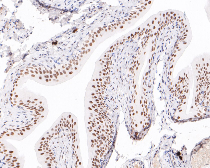 Immunohistochemical analysis of paraffin-embedded rat bladder tissue using anti-POLR2A antibody. The section was pre-treated using heat mediated antigen retrieval with sodium citrate buffer (pH 6.0) for 20 minutes. The tissues were blocked in 1% BSA for 30 minutes at room temperature, washed with ddH2O and PBS, and then probed with the primary antibody (HA600062, 1/400)  for 30 minutes at room temperature. The detection was performed using an HRP conjugated compact polymer system. DAB was used as the chromogen. Tissues were counterstained with hematoxylin and mounted with DPX.