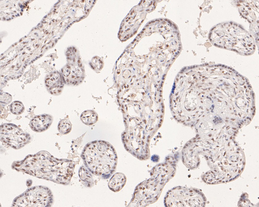 Immunohistochemical analysis of paraffin-embedded human placenta tissue using anti-POLR2A antibody. The section was pre-treated using heat mediated antigen retrieval with sodium citrate buffer (pH 6.0) for 20 minutes. The tissues were blocked in 1% BSA for 30 minutes at room temperature, washed with ddH2O and PBS, and then probed with the primary antibody (HA600062, 1/100)  for 30 minutes at room temperature. The detection was performed using an HRP conjugated compact polymer system. DAB was used as the chromogen. Tissues were counterstained with hematoxylin and mounted with DPX.
