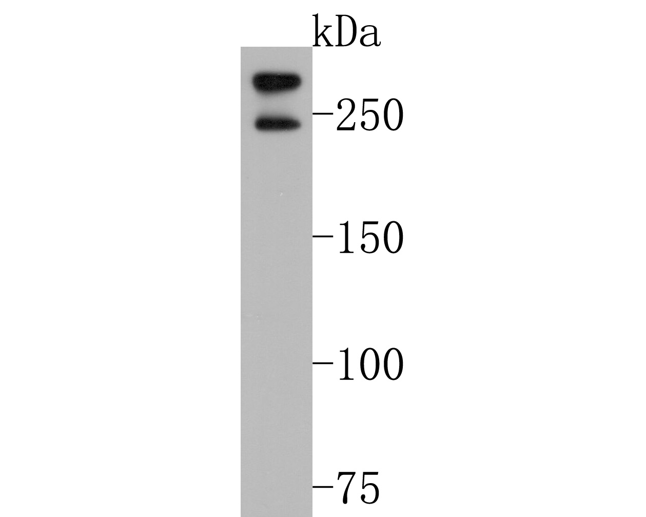 Western blot analysis of POLR2A on MCF-7 cell lysates. Proteins were transferred to a PVDF membrane and blocked with 5% NFDM/TBST for 1 hour at room temperature. The primary antibody (HA600061, 1/500) was used in 5% NFDM/TBST at room temperature for 2 hours. Goat Anti-Mouse IgG - HRP Secondary Antibody (HA1006) at 1:20,000 dilution was used for 1 hour at room temperature.