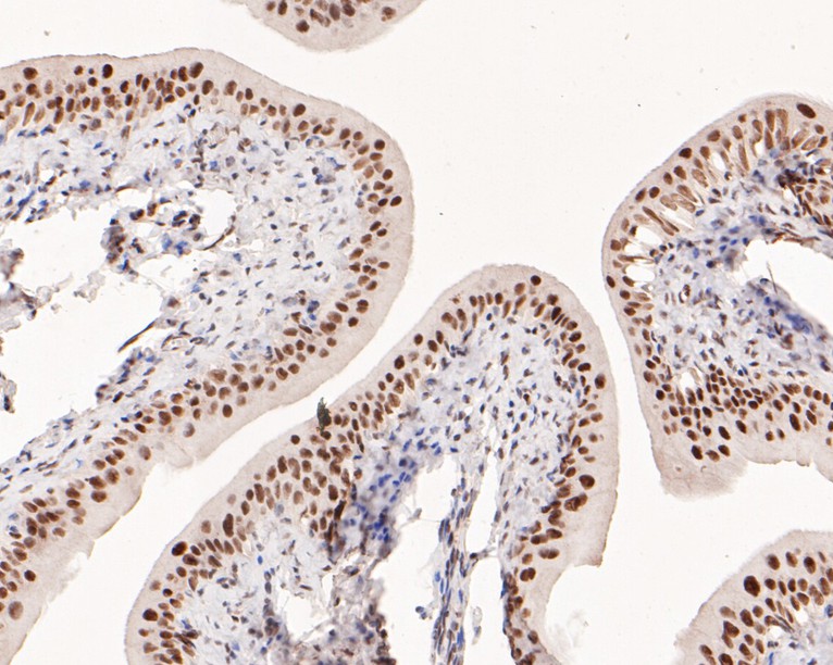 Immunohistochemical analysis of paraffin-embedded rat bladder tissue using anti-POLR2A antibody. The section was pre-treated using heat mediated antigen retrieval with sodium citrate buffer (pH 6.0) for 20 minutes. The tissues were blocked in 1% BSA for 30 minutes at room temperature, washed with ddH2O and PBS, and then probed with the primary antibody (HA600061, 1/400)  for 30 minutes at room temperature. The detection was performed using an HRP conjugated compact polymer system. DAB was used as the chromogen. Tissues were counterstained with hematoxylin and mounted with DPX.