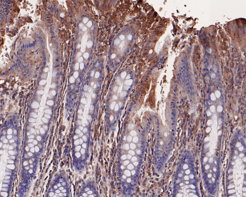 Immunohistochemical analysis of paraffin-embedded human colon tissue using anti-LRP6 antibody. The section was pre-treated using heat mediated antigen retrieval with Tris-EDTA buffer (pH 9.0) for 20 minutes.The tissues were blocked in 1% BSA for 30 minutes at room temperature, washed with ddH2O and PBS, and then probed with the primary antibody (HA600065, 1/100) for 30 minutes at room temperature. The detection was performed using an HRP conjugated compact polymer system. DAB was used as the chromogen. Tissues were counterstained with hematoxylin and mounted with DPX.