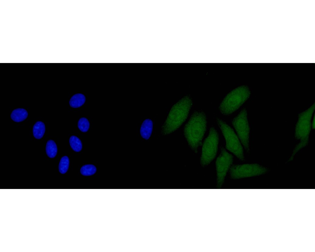 ICC staining of CLIC2 in HepG2 cells (green). Formalin fixed cells were permeabilized with 0.1% Triton X-100 in TBS for 10 minutes at room temperature and blocked with 10% negative goat serum for 15 minutes at room temperature. Cells were probed with the primary antibody (HA600064, 1/50) for 1 hour at room temperature, washed with PBS. Alexa Fluor®488 conjugate-Goat anti-Mouse IgG was used as the secondary antibody at 1/1,000 dilution. The nuclear counter stain is DAPI (blue).