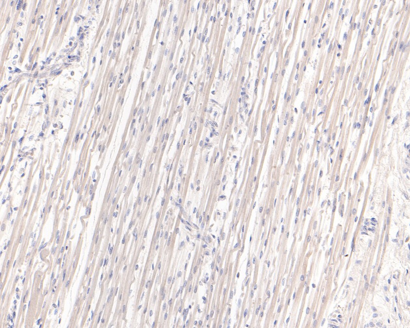Immunohistochemical analysis of paraffin-embedded human fetal skeletal muscle tissue using anti-CLIC2 antibody. The section was pre-treated using heat mediated antigen retrieval with Tris-EDTA buffer (pH 9.0) for 20 minutes.The tissues were blocked in 1% BSA for 30 minutes at room temperature, washed with ddH2O and PBS, and then probed with the primary antibody (HA600064, 1/400) for 30 minutes at room temperature. The detection was performed using an HRP conjugated compact polymer system. DAB was used as the chromogen. Tissues were counterstained with hematoxylin and mounted with DPX.