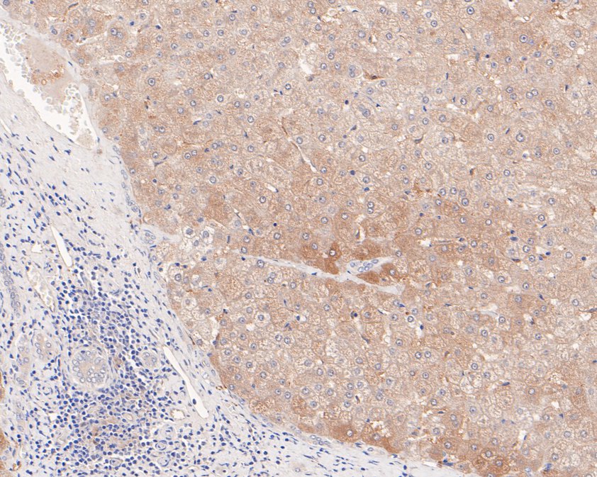 Immunohistochemical analysis of paraffin-embedded human liver tissue using anti-CLIC2 antibody. The section was pre-treated using heat mediated antigen retrieval with Tris-EDTA buffer (pH 9.0) for 20 minutes.The tissues were blocked in 1% BSA for 30 minutes at room temperature, washed with ddH2O and PBS, and then probed with the primary antibody (HA600064, 1/400) for 30 minutes at room temperature. The detection was performed using an HRP conjugated compact polymer system. DAB was used as the chromogen. Tissues were counterstained with hematoxylin and mounted with DPX.