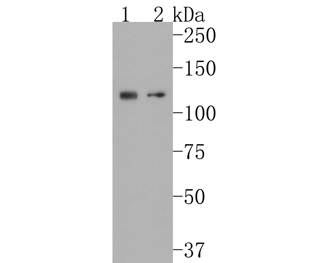 Western blot analysis of  on different lysates. Proteins were transferred to a PVDF membrane and blocked with 5% NFDM/TBST for 1 hour at room temperature. The primary antibody (HA600072, 1/500) was used in 5% NFDM/TBST at room temperature for 2 hours. Goat Anti-Mouse IgG - HRP Secondary Antibody (HA1006) at 1:20,000 dilution was used for 1 hour at room temperature.<br />
Positive control:<br />
Lane 1: A549 cell lysate<br />
Lane 2: A431 cell lysate<br />
<br />
Predicted band size: 76.5 kDa<br />
Observed band size: 120 kDa