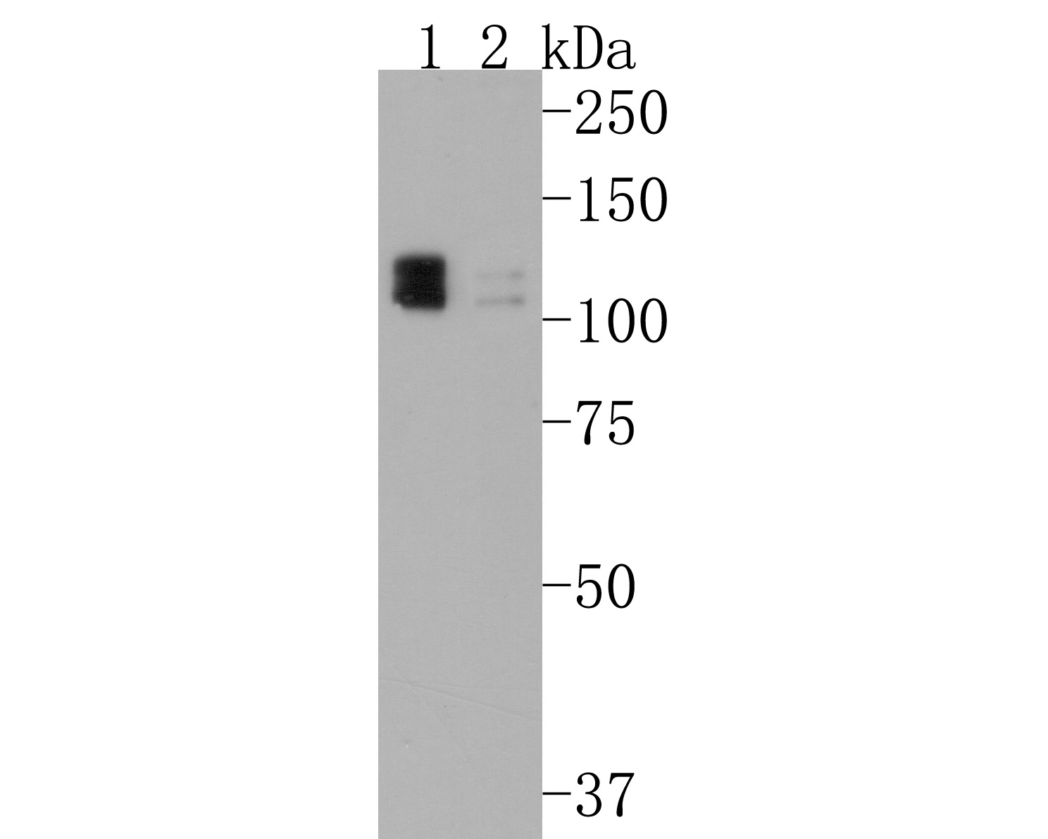 Western blot analysis of Calpastatin on different lysates. Proteins were transferred to a PVDF membrane and blocked with 5% BSA in PBS for 1 hour at room temperature. The primary antibody (HA600072, 1/500) was used in 5% BSA at room temperature for 2 hours. Goat Anti-Mouse IgG - HRP Secondary Antibody (HA1006) at 1:20,000 dilution was used for 1 hour at room temperature.<br />
Positive control:<br />
Lane 1: Hela cell lysate<br />
Lane 2: SiHa cell lysate<br />
<br />
Predicted band size: 76.5 kDa<br />
Observed band size: 110-120 kDa