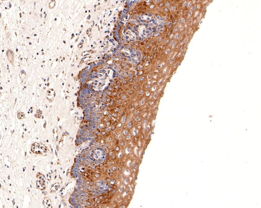 Immunohistochemical analysis of paraffin-embedded human esophagus tissue using anti-Calpastatin antibody. The section was pre-treated using heat mediated antigen retrieval with Tris-EDTA buffer (pH 9.0) for 20 minutes.The tissues were blocked in 1% BSA for 30 minutes at room temperature, washed with ddH2O and PBS, and then probed with the primary antibody (HA600072, 1/200) for 30 minutes at room temperature. The detection was performed using an HRP conjugated compact polymer system. DAB was used as the chromogen. Tissues were counterstained with hematoxylin and mounted with DPX.