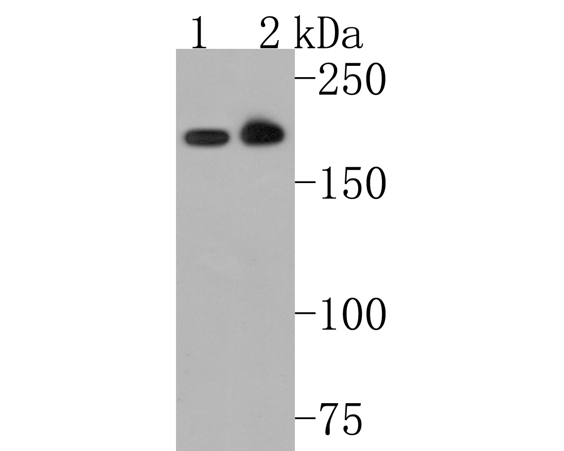 Western blot analysis of Clathrin heavy chain on different lysates. Proteins were transferred to a PVDF membrane and blocked with 5% BSA in PBS for 1 hour at room temperature. The primary antibody (HA500499, 1/2,000) was used in 5% BSA at room temperature for 2 hours. Goat Anti-Rabbit IgG - HRP Secondary Antibody (HA1001) at 1:200,000 dilution was used for 1 hour at room temperature.<br />
Positive control: <br />
Lane 1: A431 cell lysate<br />
Lane 2: Mouse brain tissue lysate