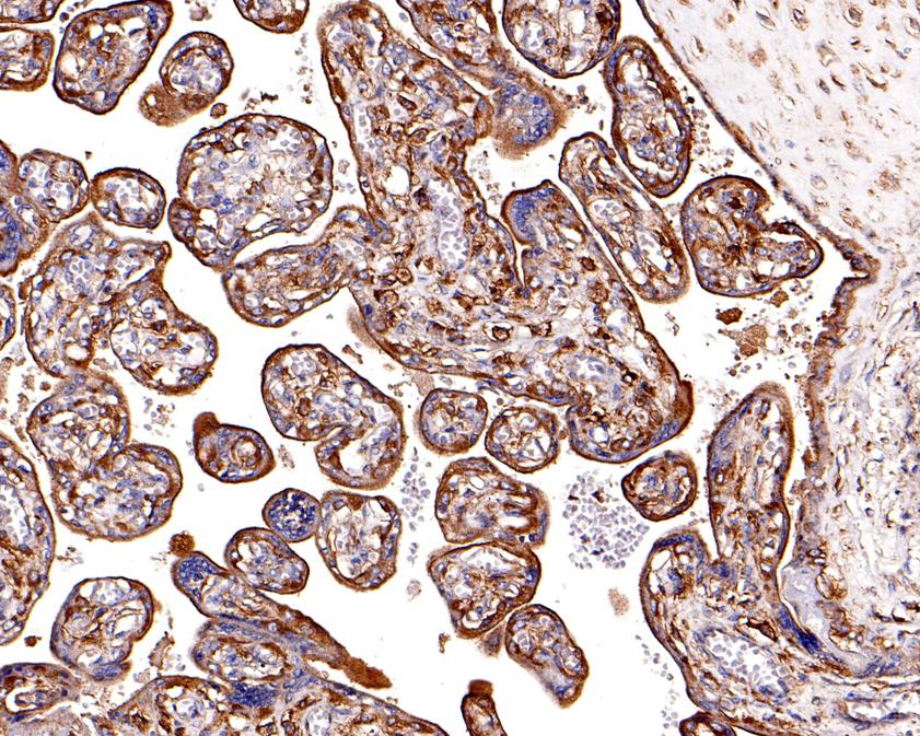 Immunohistochemical analysis of paraffin-embedded human placenta tissue using anti-Clathrin heavy chain antibody. The section was pre-treated using heat mediated antigen retrieval with Tris-EDTA buffer (pH 9.0) for 20 minutes.The tissues were blocked in 1% BSA for 30 minutes at room temperature, washed with ddH2O and PBS, and then probed with the primary antibody (HA500499, 1/1,000) for 30 minutes at room temperature. The detection was performed using an HRP conjugated compact polymer system. DAB was used as the chromogen. Tissues were counterstained with hematoxylin and mounted with DPX.