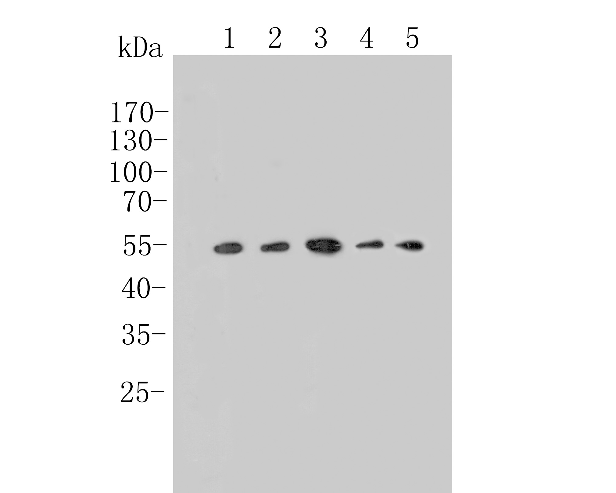Western blot analysis of TGF beta 1 on different lysates. Proteins were transferred to a PVDF membrane and blocked with 5% BSA in PBS for 1 hour at room temperature. The primary antibody (HA500496, 1/500) was used in 5% BSA at room temperature for 2 hours. Goat Anti-Rabbit IgG - HRP Secondary Antibody (HA1001) at 1:200,000 dilution was used for 1 hour at room temperature.<br />
Positive control: <br />
Lane 1: PC-3 cell lysate<br />
Lane 2: A549 cell lysate<br />
Lane 3: U87 cell lysate<br />
Lane 4: Hela cell lysate<br />
Lane 5: K562 cell lysate