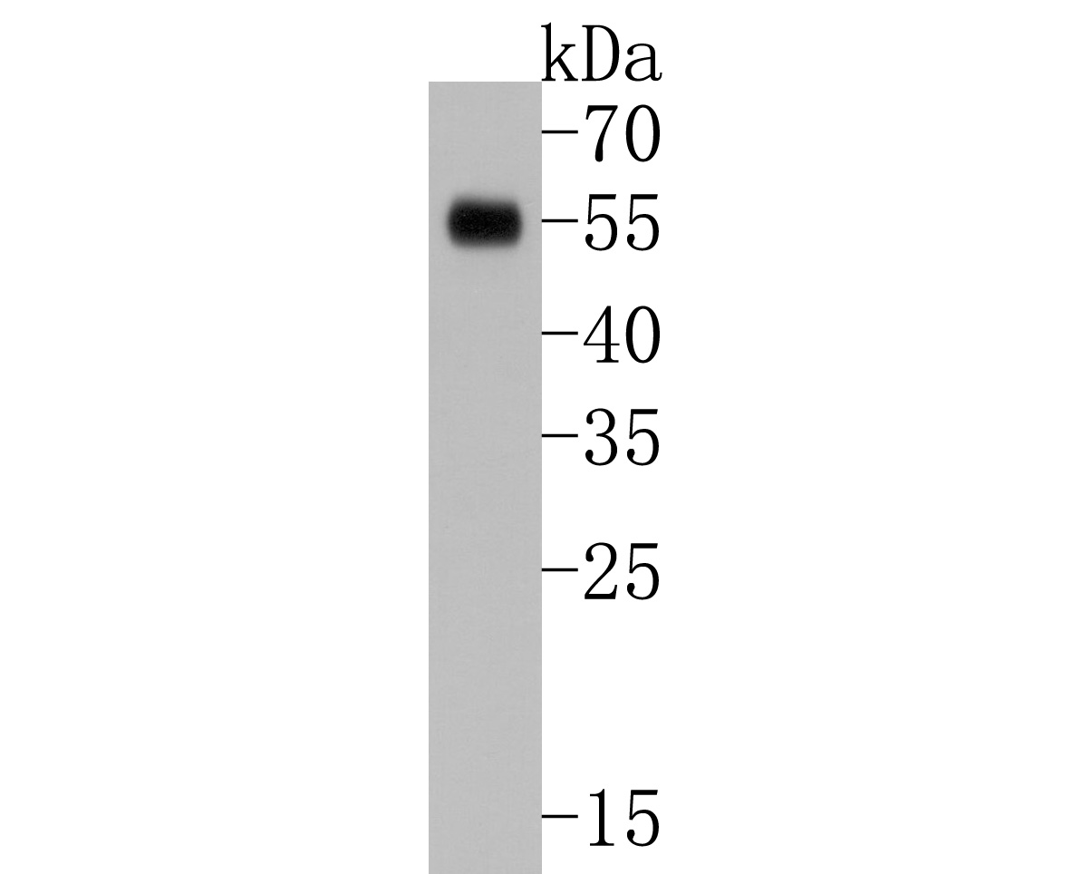 Western blot analysis of SOX17 on SKOV-3 cell lysates. Proteins were transferred to a PVDF membrane and blocked with 5% BSA in PBS for 1 hour at room temperature. The primary antibody (HA500495, 1/500) was used in 5% BSA at room temperature for 2 hours. Goat Anti-Rabbit IgG - HRP Secondary Antibody (HA1001) at 1:200,000 dilution was used for 1 hour at room temperature.