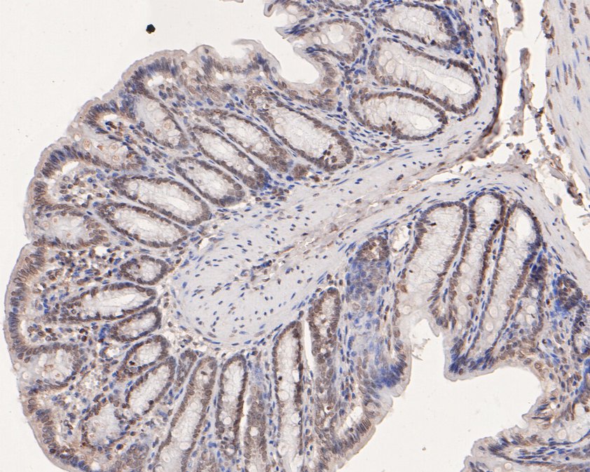 Immunohistochemical analysis of paraffin-embedded rat small intestine tissue using anti-SOX17 antibody. The section was pre-treated using heat mediated antigen retrieval with sodium citrate buffer (pH 6.0) for 20 minutes. The tissues were blocked in 1% BSA for 30 minutes at room temperature, washed with ddH2O and PBS, and then probed with the primary antibody (HA500495, 1/100)  for 30 minutes at room temperature. The detection was performed using an HRP conjugated compact polymer system. DAB was used as the chromogen. Tissues were counterstained with hematoxylin and mounted with DPX.