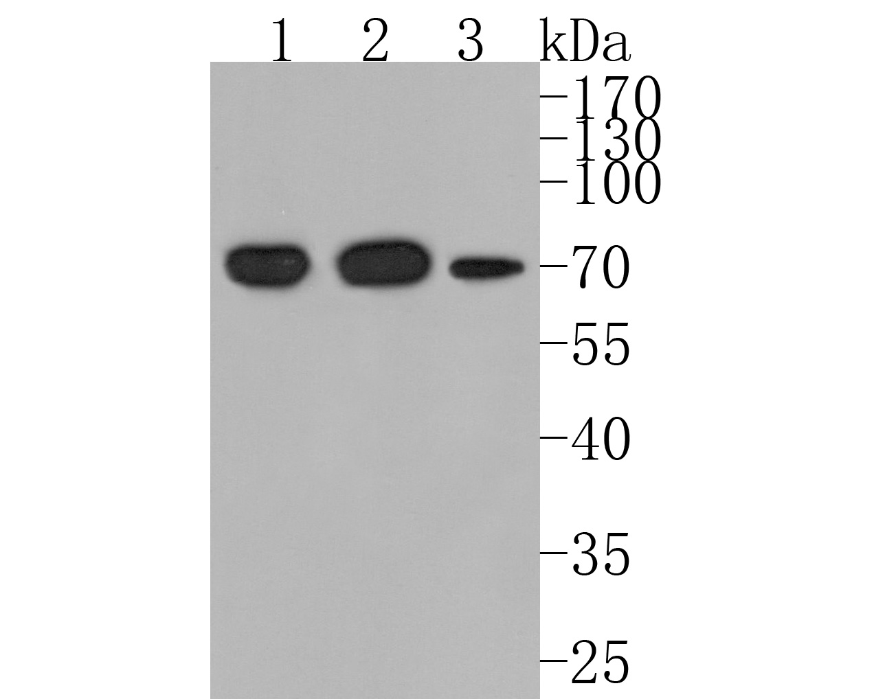 Western blot analysis of TAF15 on different lysates. Proteins were transferred to a PVDF membrane and blocked with 5% NFDM/TBST for 1 hour at room temperature. The primary antibody (HA720098, 1/500) was used in 5% NFDM/TBST at room temperature for 2 hours. Goat Anti-Rabbit IgG - HRP Secondary Antibody (HA1001) at 1:200,000 dilution was used for 1 hour at room temperature.<br />
Positive control: <br />
Lane 1: Daudi cell lysate<br />
Lane 2: HL-60 cell lysate<br />
Lane 3: A549 cell lysate