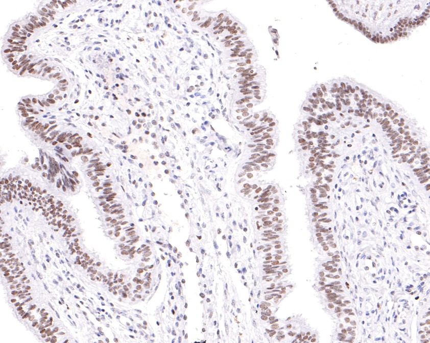 Immunohistochemical analysis of paraffin-embedded human fallopian tube tissue using anti-TAF15 antibody. The section was pre-treated using heat mediated antigen retrieval with sodium citrate buffer (pH 6.0) for 20 minutes. The tissues were blocked in 1% BSA for 30 minutes at room temperature, washed with ddH2O and PBS, and then probed with the primary antibody (HA720098, 1/100)  for 30 minutes at room temperature. The detection was performed using an HRP conjugated compact polymer system. DAB was used as the chromogen. Tissues were counterstained with hematoxylin and mounted with DPX.