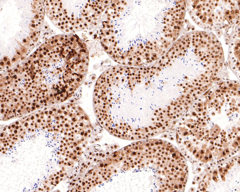 Immunohistochemical analysis of paraffin-embedded mouse testis tissue using anti-TAF15 antibody. The section was pre-treated using heat mediated antigen retrieval with sodium citrate buffer (pH 6.0) for 20 minutes. The tissues were blocked in 1% BSA for 30 minutes at room temperature, washed with ddH2O and PBS, and then probed with the primary antibody (HA720098, 1/400)  for 30 minutes at room temperature. The detection was performed using an HRP conjugated compact polymer system. DAB was used as the chromogen. Tissues were counterstained with hematoxylin and mounted with DPX.