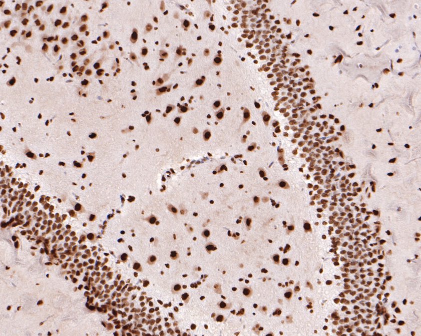 Immunohistochemical analysis of paraffin-embedded rat brain tissue using anti-TAF15 antibody. The section was pre-treated using heat mediated antigen retrieval with sodium citrate buffer (pH 6.0) for 20 minutes. The tissues were blocked in 1% BSA for 30 minutes at room temperature, washed with ddH2O and PBS, and then probed with the primary antibody (HA720098, 1/400)  for 30 minutes at room temperature. The detection was performed using an HRP conjugated compact polymer system. DAB was used as the chromogen. Tissues were counterstained with hematoxylin and mounted with DPX.