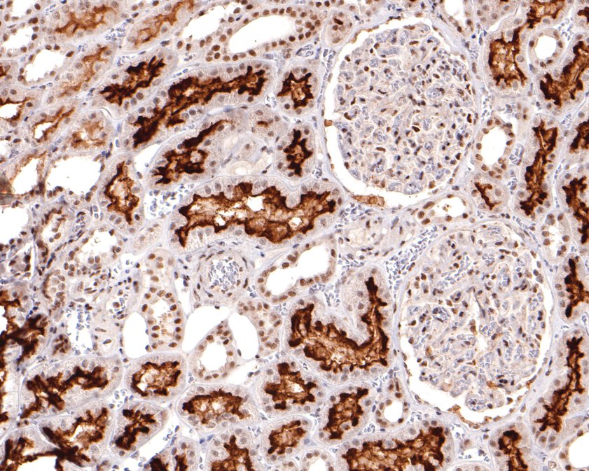 Immunohistochemical analysis of paraffin-embedded human kidney tissue using anti-DPF2 antibody. The section was pre-treated using heat mediated antigen retrieval with sodium citrate buffer (pH 6.0) for 20 minutes. The tissues were blocked in 1% BSA for 30 minutes at room temperature, washed with ddH2O and PBS, and then probed with the primary antibody (HA720105, 1/400)  for 30 minutes at room temperature. The detection was performed using an HRP conjugated compact polymer system. DAB was used as the chromogen. Tissues were counterstained with hematoxylin and mounted with DPX.