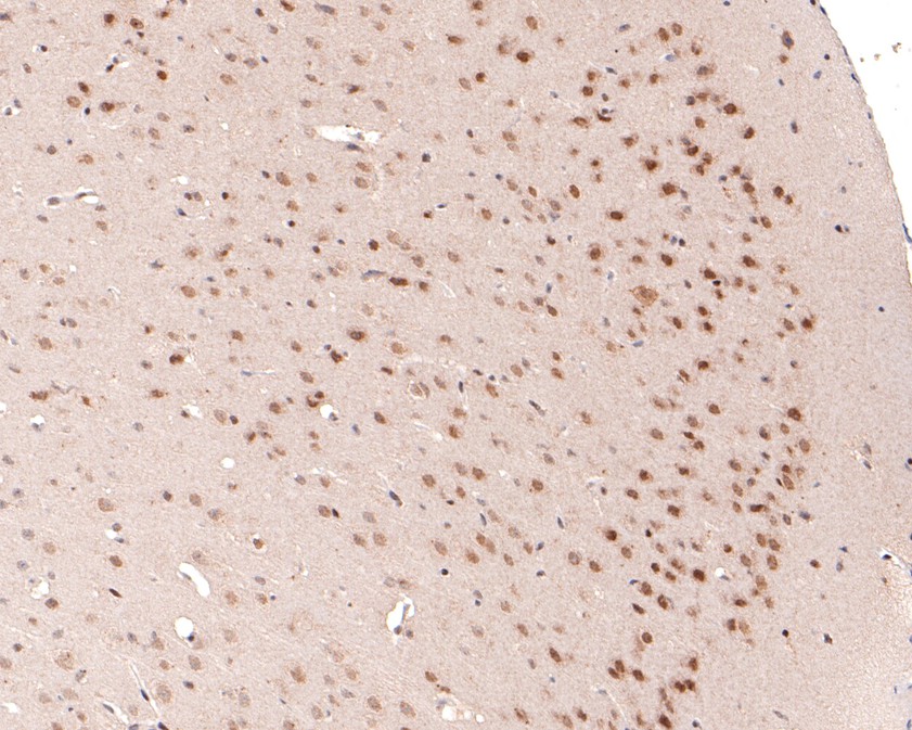 Immunohistochemical analysis of paraffin-embedded mouse brain tissue using anti-DPF2 antibody. The section was pre-treated using heat mediated antigen retrieval with sodium citrate buffer (pH 6.0) for 20 minutes. The tissues were blocked in 1% BSA for 30 minutes at room temperature, washed with ddH2O and PBS, and then probed with the primary antibody (HA720105, 1/400)  for 30 minutes at room temperature. The detection was performed using an HRP conjugated compact polymer system. DAB was used as the chromogen. Tissues were counterstained with hematoxylin and mounted with DPX.