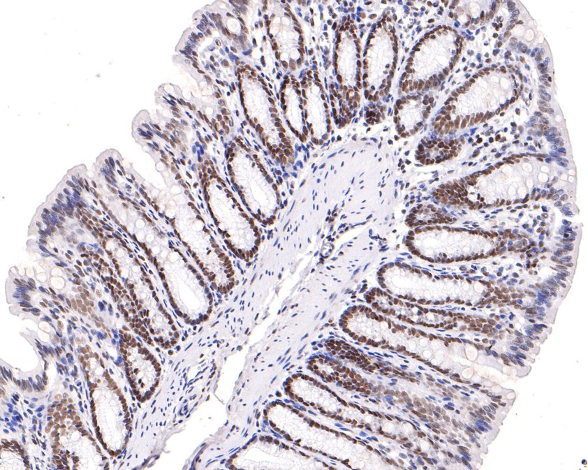 Immunohistochemical analysis of paraffin-embedded rat colon tissue using anti-DPF2 antibody. The section was pre-treated using heat mediated antigen retrieval with sodium citrate buffer (pH 6.0) for 20 minutes. The tissues were blocked in 1% BSA for 30 minutes at room temperature, washed with ddH2O and PBS, and then probed with the primary antibody (HA720105, 1/400)  for 30 minutes at room temperature. The detection was performed using an HRP conjugated compact polymer system. DAB was used as the chromogen. Tissues were counterstained with hematoxylin and mounted with DPX.