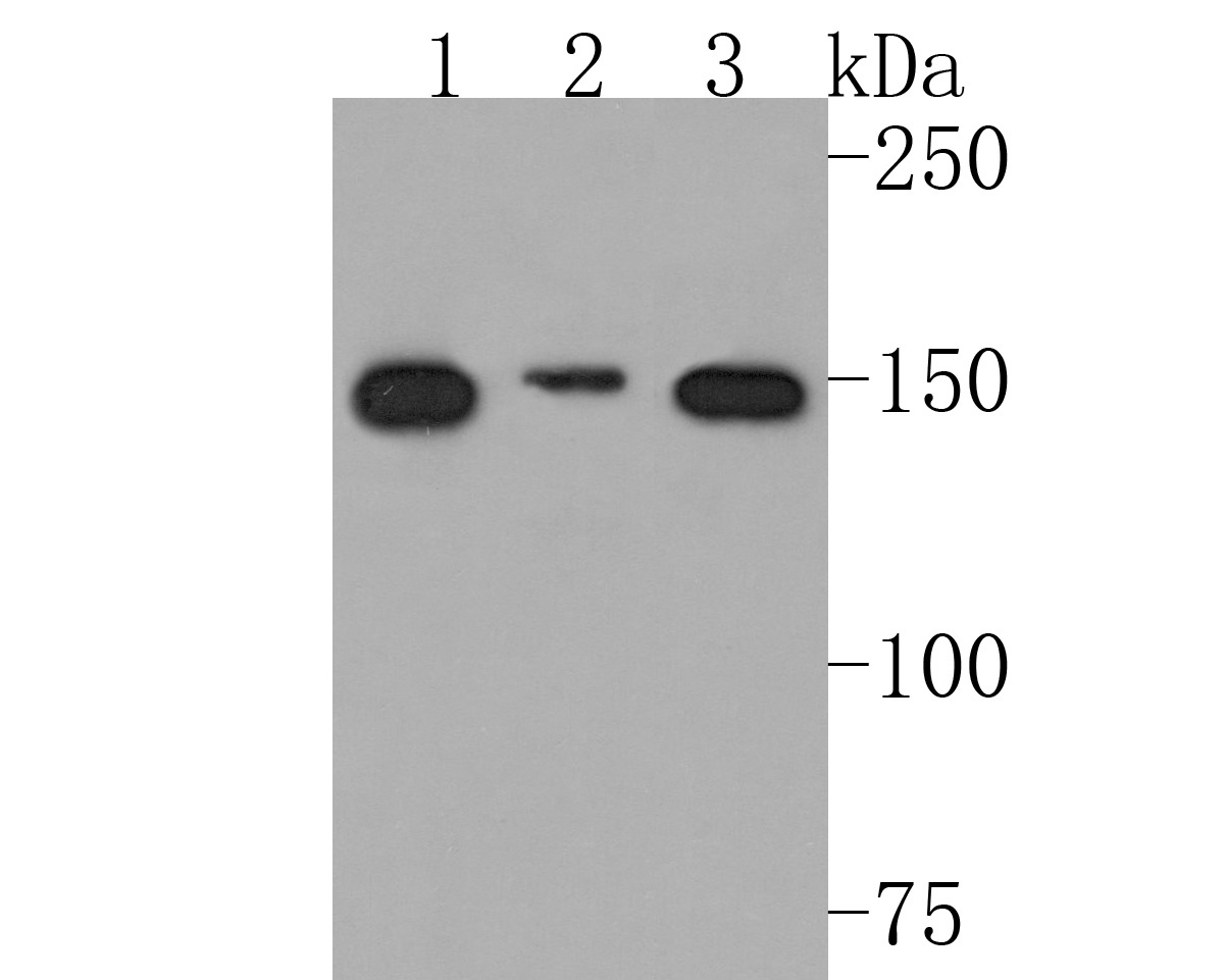 Western blot analysis of NCAPD2 on different lysates. Proteins were transferred to a PVDF membrane and blocked with 5% NFDM/TBST for 1 hour at room temperature. The primary antibody (HA720100, 1/500) was used in 5% NFDM/TBST at room temperature for 2 hours. Goat Anti-Rabbit IgG - HRP Secondary Antibody (HA1001) at 1:200,000 dilution was used for 1 hour at room temperature.<br />
Positive control: <br />
Lane 1: Hela cell lysate<br />
Lane 2: HL-60 cell lysate<br />
Lane 3: SiHa cell lysate