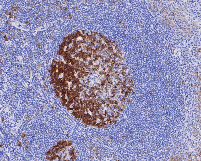 Immunohistochemical analysis of paraffin-embedded human tonsil tissue using anti-NCAPD2 antibody. The section was pre-treated using heat mediated antigen retrieval with sodium citrate buffer (pH 6.0) for 20 minutes. The tissues were blocked in 1% BSA for 30 minutes at room temperature, washed with ddH2O and PBS, and then probed with the primary antibody (HA720100, 1/100)  for 30 minutes at room temperature. The detection was performed using an HRP conjugated compact polymer system. DAB was used as the chromogen. Tissues were counterstained with hematoxylin and mounted with DPX.