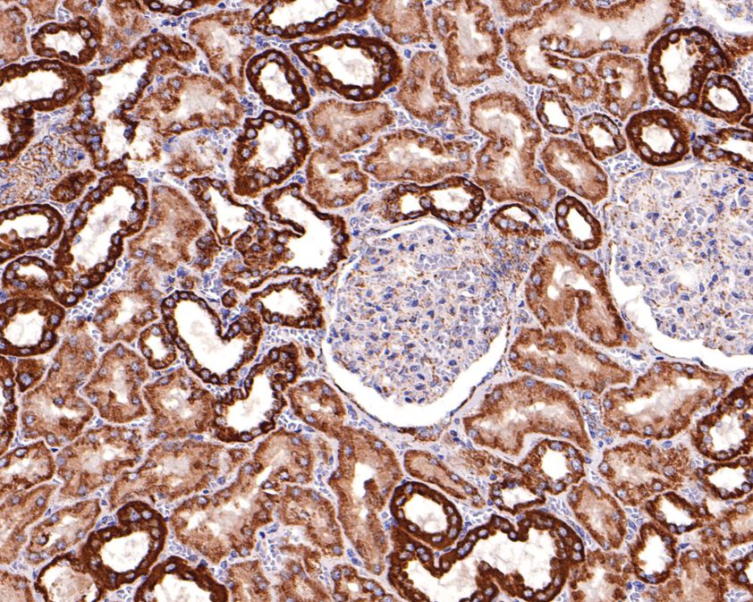 Immunohistochemical analysis of paraffin-embedded human kidney tissue using anti-UQCRH antibody. The section was pre-treated using heat mediated antigen retrieval with Tris-EDTA buffer (pH 9.0) for 20 minutes.The tissues were blocked in 1% BSA for 30 minutes at room temperature, washed with ddH2O and PBS, and then probed with the primary antibody (HA720113, 1/400) for 30 minutes at room temperature. The detection was performed using an HRP conjugated compact polymer system. DAB was used as the chromogen. Tissues were counterstained with hematoxylin and mounted with DPX.
