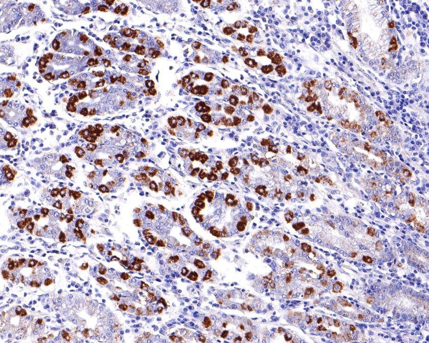 Immunohistochemical analysis of paraffin-embedded human stomach tissue using anti-UQCRH antibody. The section was pre-treated using heat mediated antigen retrieval with Tris-EDTA buffer (pH 9.0) for 20 minutes.The tissues were blocked in 1% BSA for 30 minutes at room temperature, washed with ddH2O and PBS, and then probed with the primary antibody (HA720113, 1/400) for 30 minutes at room temperature. The detection was performed using an HRP conjugated compact polymer system. DAB was used as the chromogen. Tissues were counterstained with hematoxylin and mounted with DPX.