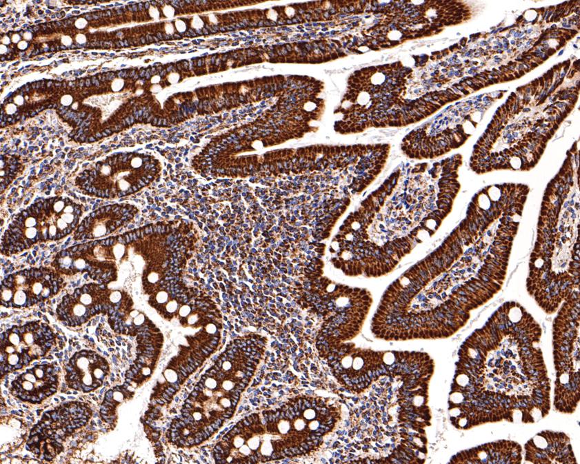 Immunohistochemical analysis of paraffin-embedded human small intestine tissue using anti-UQCRH antibody. The section was pre-treated using heat mediated antigen retrieval with Tris-EDTA buffer (pH 9.0) for 20 minutes.The tissues were blocked in 1% BSA for 30 minutes at room temperature, washed with ddH2O and PBS, and then probed with the primary antibody (HA720113, 1/400) for 30 minutes at room temperature. The detection was performed using an HRP conjugated compact polymer system. DAB was used as the chromogen. Tissues were counterstained with hematoxylin and mounted with DPX.