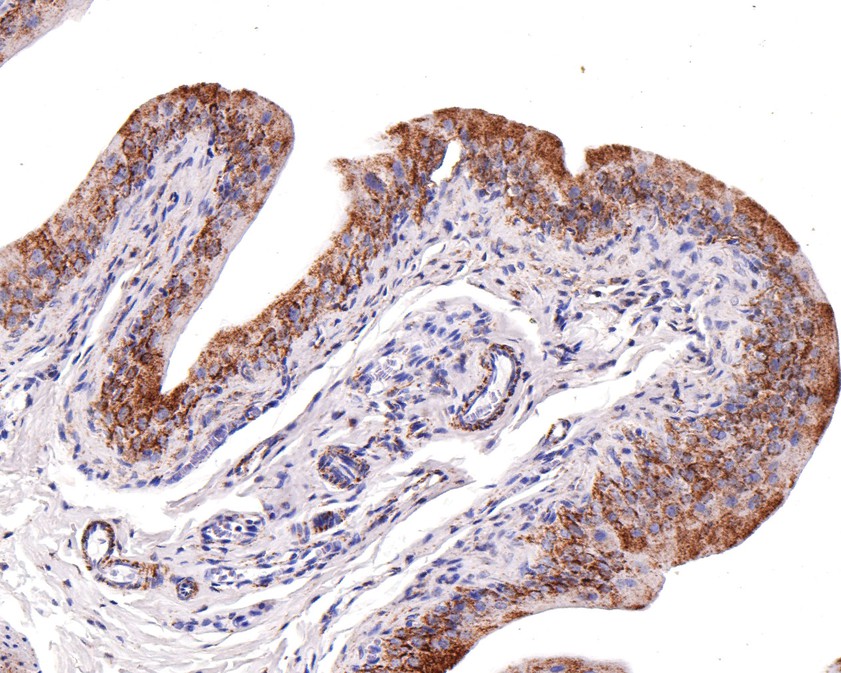 Immunohistochemical analysis of paraffin-embedded rat bladder tissue using anti-UQCRH antibody. The section was pre-treated using heat mediated antigen retrieval with Tris-EDTA buffer (pH 9.0) for 20 minutes.The tissues were blocked in 1% BSA for 30 minutes at room temperature, washed with ddH2O and PBS, and then probed with the primary antibody (HA720113, 1/100) for 30 minutes at room temperature. The detection was performed using an HRP conjugated compact polymer system. DAB was used as the chromogen. Tissues were counterstained with hematoxylin and mounted with DPX.
