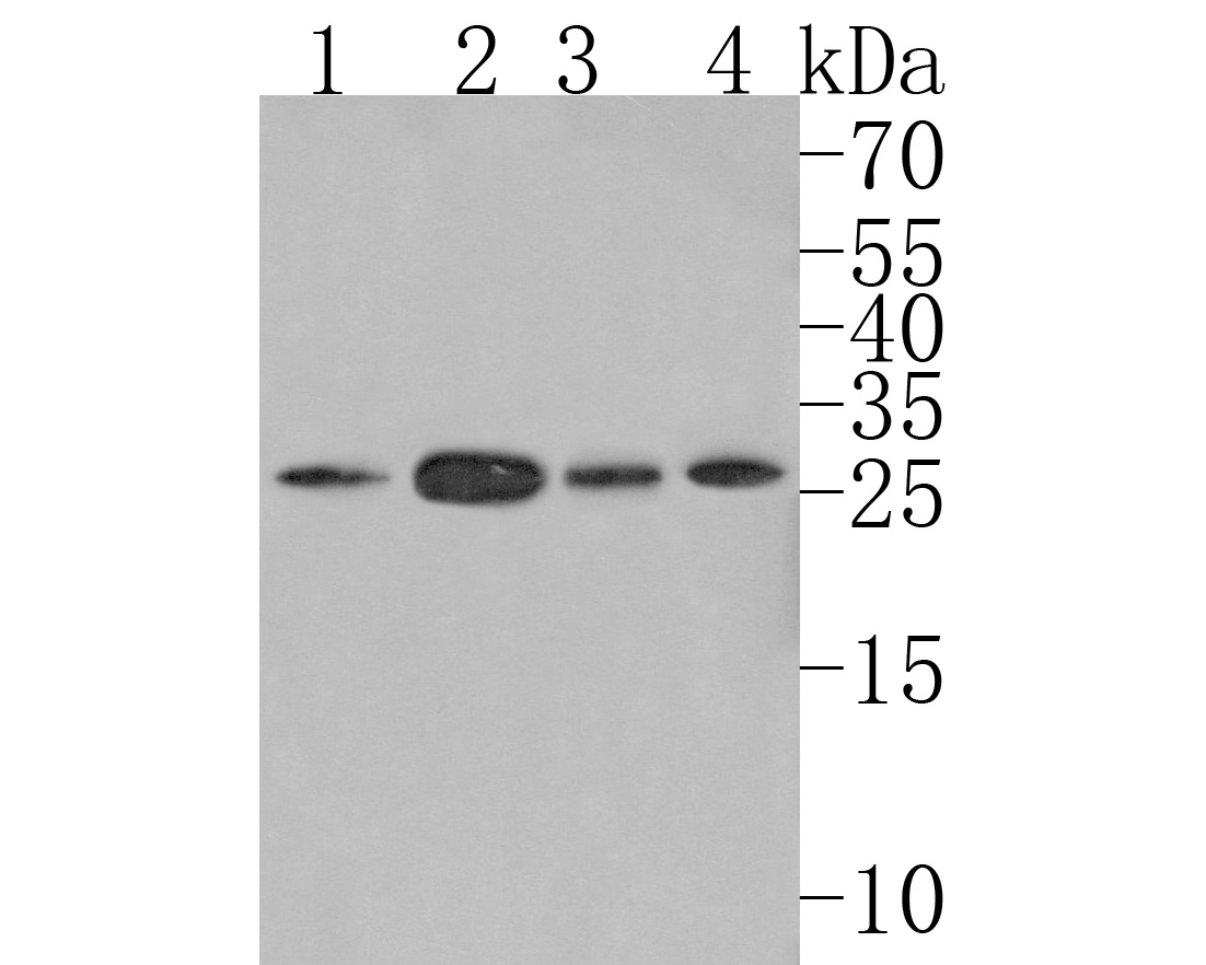 Western blot analysis of  on different lysates. Proteins were transferred to a PVDF membrane and blocked with 5% NFDM/TBST for 1 hour at room temperature. The primary antibody (HA720097, 1/500) was used in 5% NFDM/TBST at room temperature for 2 hours. Goat Anti-Rabbit IgG - HRP Secondary Antibody (HA1001) at 1:200,000 dilution was used for 1 hour at room temperature.<br />
Positive control: <br />
Lane 1: THP-1 cell lysate<br />
Lane 2: 293 cell lysate<br />
Lane 3: Mouse kidney tissue lysate<br />
Lane 4: Rat skin tissue lysate
