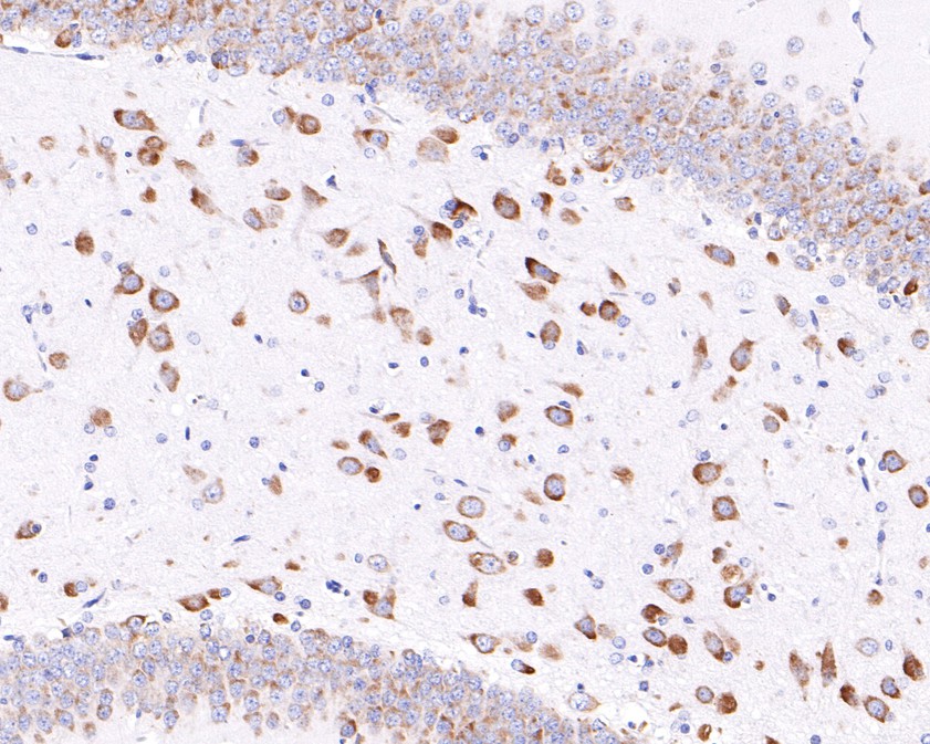 Immunohistochemical analysis of paraffin-embedded rat brain tissue using anti-RPL13 antibody. The section was pre-treated using heat mediated antigen retrieval with Tris-EDTA buffer (pH 9.0) for 20 minutes.The tissues were blocked in 1% BSA for 30 minutes at room temperature, washed with ddH2O and PBS, and then probed with the primary antibody (HA720097, 1/400) for 30 minutes at room temperature. The detection was performed using an HRP conjugated compact polymer system. DAB was used as the chromogen. Tissues were counterstained with hematoxylin and mounted with DPX.