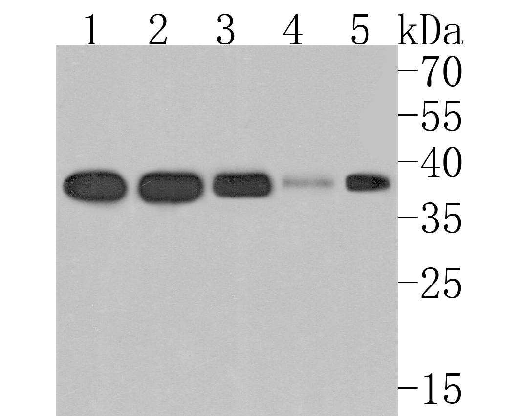 Western blot analysis of Syntaxin 16 on different lysates. Proteins were transferred to a PVDF membrane and blocked with 5% BSA in PBS for 1 hour at room temperature. The primary antibody (HA720107, 1/500) was used in 5% BSA at room temperature for 2 hours. Goat Anti-Rabbit IgG - HRP Secondary Antibody (HA1001) at 1:200,000 dilution was used for 1 hour at room temperature.<br />
Positive control: <br />
Lane 2: MCF-7 cell lysate<br />
Lane 2: SK-Br-3 cell lysate<br />
Lane 2: Hela cell lysate<br />
Lane 1: Mouse lung tissue lysate<br />
Lane 2: Rat testis tissue lysate