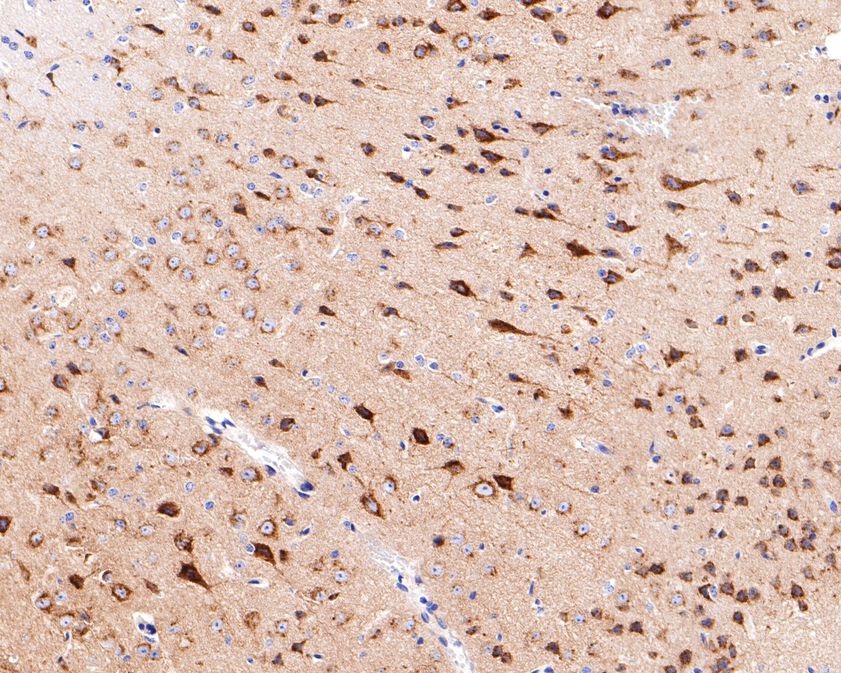 Immunohistochemical analysis of paraffin-embedded mouse brain tissue using anti-Syntaxin 16 antibody. The section was pre-treated using heat mediated antigen retrieval with Tris-EDTA buffer (pH 9.0) for 20 minutes.The tissues were blocked in 1% BSA for 30 minutes at room temperature, washed with ddH2O and PBS, and then probed with the primary antibody (HA720107, 1/400) for 30 minutes at room temperature. The detection was performed using an HRP conjugated compact polymer system. DAB was used as the chromogen. Tissues were counterstained with hematoxylin and mounted with DPX.