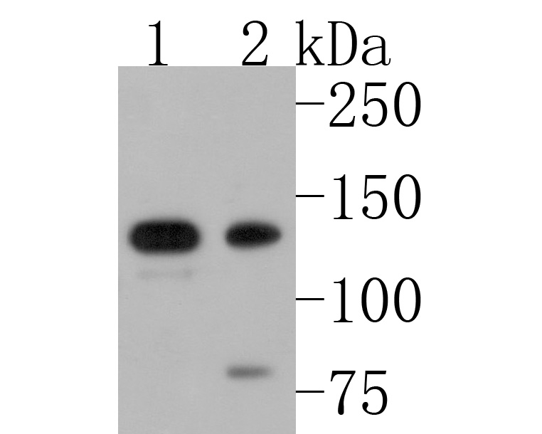 Western blot analysis of PKN2 on different lysates. Proteins were transferred to a PVDF membrane and blocked with 5% NFDM/TBST for 1 hour at room temperature. The primary antibody (HA720102, 1/500) was used in 5% NFDM/TBST at room temperature for 2 hours. Goat Anti-Rabbit IgG - HRP Secondary Antibody (HA1001) at 1:200,000 dilution was used for 1 hour at room temperature.<br />
Positive control: <br />
Lane 1: A431 cell lysate<br />
Lane 2: Rat lung tissue lysate<br />
<br />
Predicted band size: 112 kDa<br />
Observed band size: 135 kDa