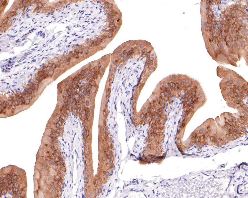 Immunohistochemical analysis of paraffin-embedded rat bladder tissue using anti-PKN2 antibody. The section was pre-treated using heat mediated antigen retrieval with sodium citrate buffer (pH 6.0) for 20 minutes. The tissues were blocked in 1% BSA for 30 minutes at room temperature, washed with ddH2O and PBS, and then probed with the primary antibody (HA720102, 1/400)  for 30 minutes at room temperature. The detection was performed using an HRP conjugated compact polymer system. DAB was used as the chromogen. Tissues were counterstained with hematoxylin and mounted with DPX.
