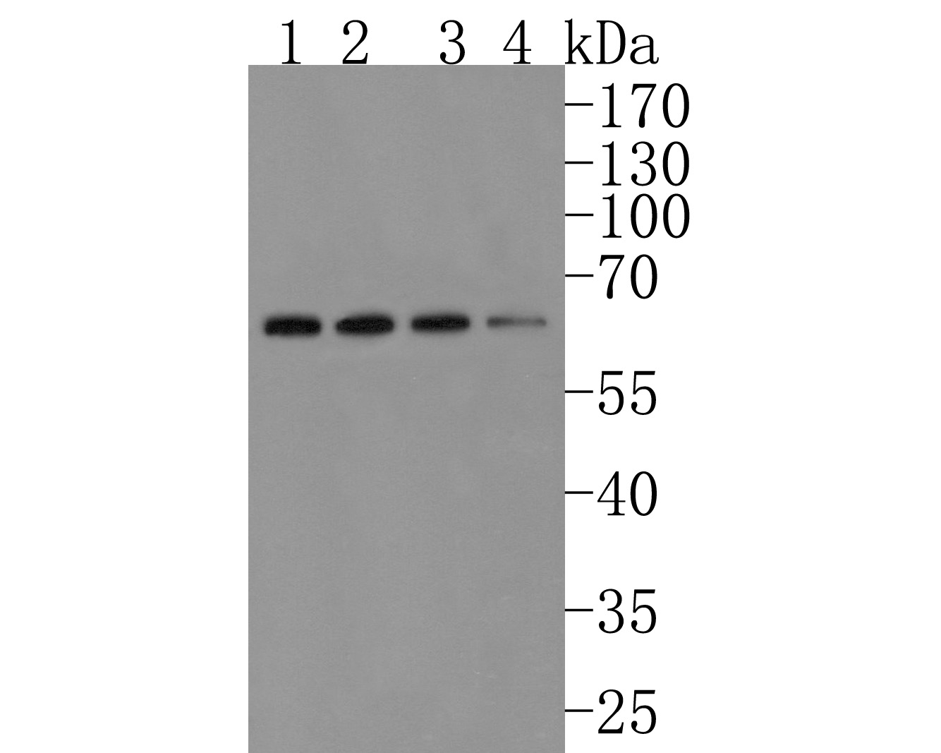 Western blot analysis of alpha 1a Adrenergic Receptor on different lysates. Proteins were transferred to a PVDF membrane and blocked with 5% NFDM/TBST for 1 hour at room temperature. The primary antibody (HA720096, 1/500) was used in 5% NFDM/TBST at room temperature for 2 hours. Goat Anti-Rabbit IgG - HRP Secondary Antibody (HA1001) at 1:200,000 dilution was used for 1 hour at room temperature.<br />
Positive control: <br />
Lane 1: Jurkat cell lysate<br />
Lane 2: SH-SY5Y cell lysate<br />
Lane 3: PC-3M cell lysate<br />
Lane 4: Mouse lung tissue lysate