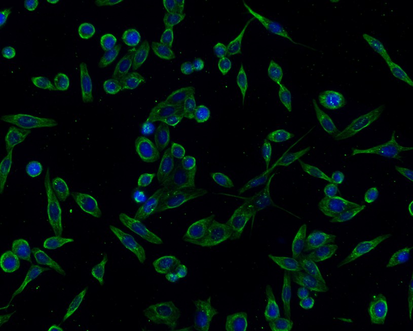 ICC staining of alpha 1a Adrenergic Receptor in SH-SY5Y cells (green). Formalin fixed cells were permeabilized with 0.1% Triton X-100 in PBS for 10 minutes at room temperature and blocked with 10% negative goat serum for 15 minutes at room temperature. Cells were probed with the primary antibody (HA720096, 1/50) for 1 hour at room temperature, washed with PBS. Alexa Fluor®488 conjugate-Goat anti-Rabbit IgG was used as the secondary antibody at 1/1,000 dilution. The nuclear counter stain is DAPI (blue).