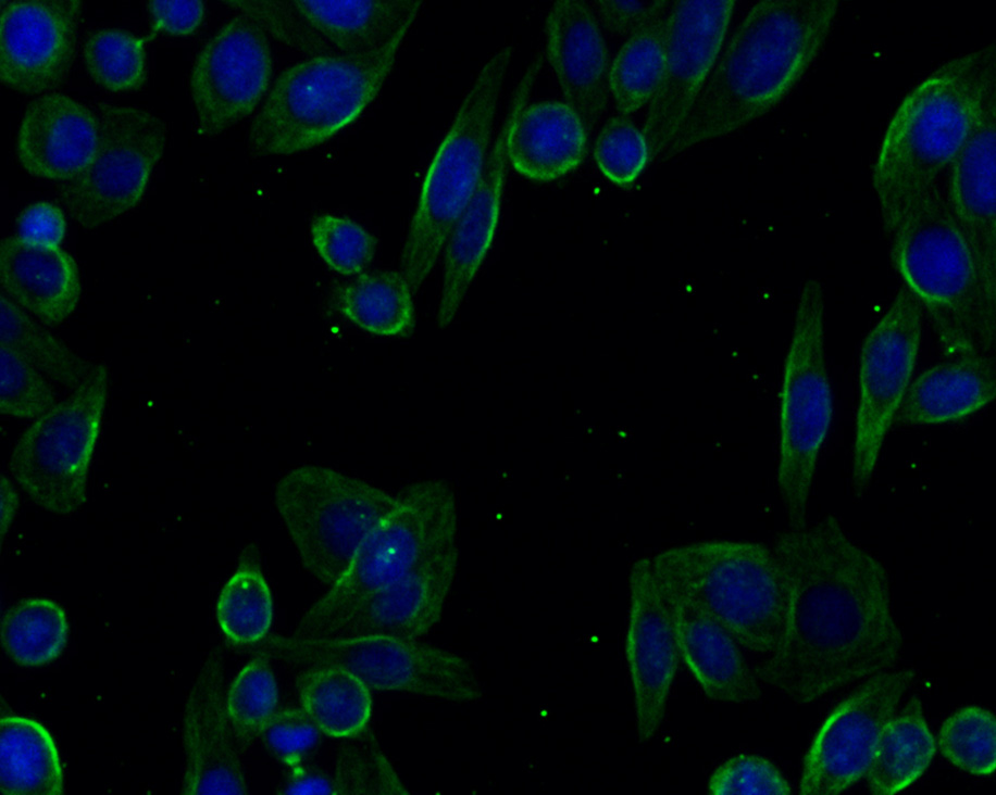 ICC staining of alpha 1a Adrenergic Receptor in SiHa cells (green). Formalin fixed cells were permeabilized with 0.1% Triton X-100 in PBS for 10 minutes at room temperature and blocked with 10% negative goat serum for 15 minutes at room temperature. Cells were probed with the primary antibody (HA720096, 1/50) for 1 hour at room temperature, washed with PBS. Alexa Fluor®488 conjugate-Goat anti-Rabbit IgG was used as the secondary antibody at 1/1,000 dilution. The nuclear counter stain is DAPI (blue).
