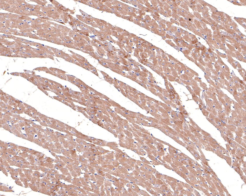 Immunohistochemical analysis of paraffin-embedded rat heart tissue using anti-alpha 1a Adrenergic Receptor antibody. The section was pre-treated using heat mediated antigen retrieval with Tris-EDTA buffer (pH 9.0) for 20 minutes.The tissues were blocked in 1% BSA for 30 minutes at room temperature, washed with ddH2O and PBS, and then probed with the primary antibody (HA720096, 1/100) for 30 minutes at room temperature. The detection was performed using an HRP conjugated compact polymer system. DAB was used as the chromogen. Tissues were counterstained with hematoxylin and mounted with DPX.