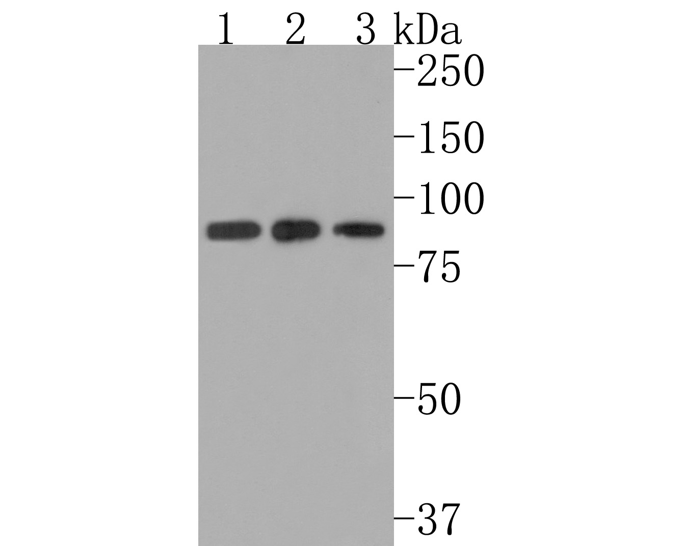 Immunohistochemical analysis of paraffin-embedded human small intestine tissue using anti-ALDH16A1 antibody. The section was pre-treated using heat mediated antigen retrieval with Tris-EDTA buffer (pH 9.0) for 20 minutes.The tissues were blocked in 1% BSA for 30 minutes at room temperature, washed with ddH2O and PBS, and then probed with the primary antibody (HA720104, 1/400) for 30 minutes at room temperature. The detection was performed using an HRP conjugated compact polymer system. DAB was used as the chromogen. Tissues were counterstained with hematoxylin and mounted with DPX.