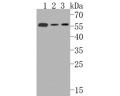 Western blot analysis of Sterol carrier protein 2 on different lysates. Proteins were transferred to a PVDF membrane and blocked with 5% NFDM/TBST for 1 hour at room temperature. The primary antibody (HA720099, 1/500) was used in 5% NFDM/TBST at room temperature for 2 hours. Goat Anti-Rabbit IgG - HRP Secondary Antibody (HA1001) at 1:200,000 dilution was used for 1 hour at room temperature.<br />
Positive control: <br />
Lane 1: SK-Br-3 cell lysate<br />
Lane 2: THP-1 cell lysate<br />
Lane 3: HL-60 cell lysate