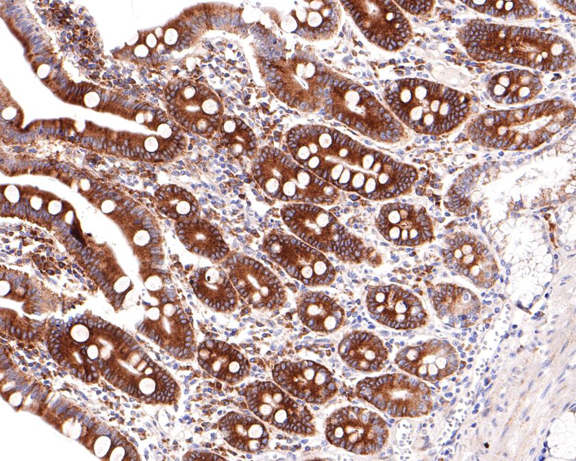 Immunohistochemical analysis of paraffin-embedded human small intestine tissue using anti-Sterol carrier protein 2 antibody. The section was pre-treated using heat mediated antigen retrieval with Tris-EDTA buffer (pH 9.0) for 20 minutes.The tissues were blocked in 1% BSA for 30 minutes at room temperature, washed with ddH2O and PBS, and then probed with the primary antibody (HA720099, 1/400) for 30 minutes at room temperature. The detection was performed using an HRP conjugated compact polymer system. DAB was used as the chromogen. Tissues were counterstained with hematoxylin and mounted with DPX.