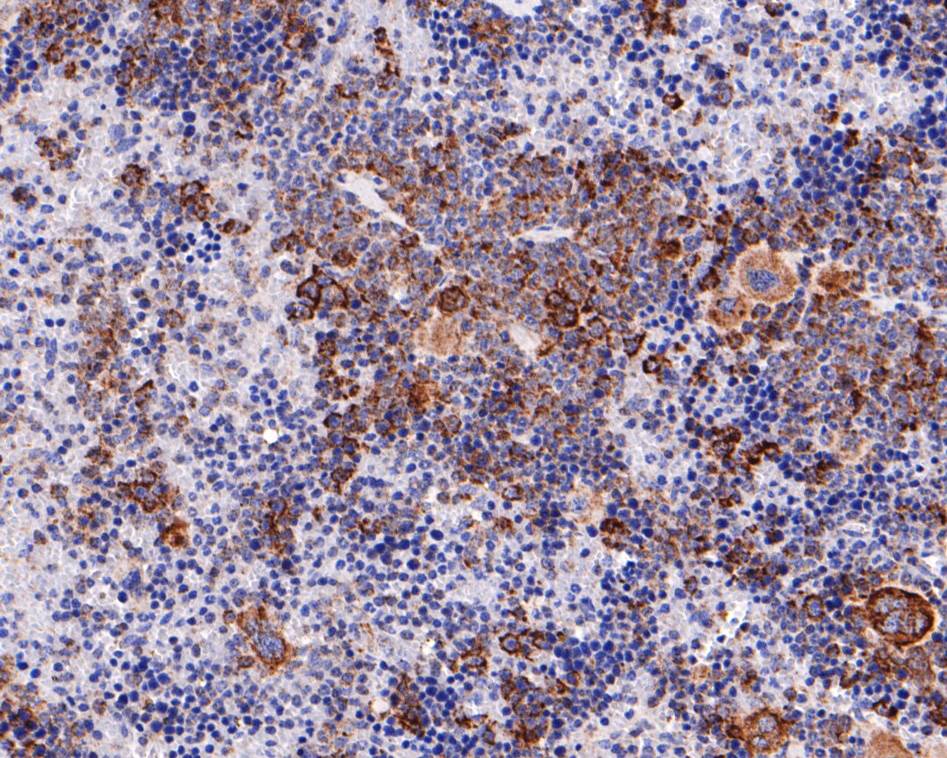 Immunohistochemical analysis of paraffin-embedded mouse spleen tissue using anti-Sterol carrier protein 2 antibody. The section was pre-treated using heat mediated antigen retrieval with Tris-EDTA buffer (pH 9.0) for 20 minutes.The tissues were blocked in 1% BSA for 30 minutes at room temperature, washed with ddH2O and PBS, and then probed with the primary antibody (HA720099, 1/100) for 30 minutes at room temperature. The detection was performed using an HRP conjugated compact polymer system. DAB was used as the chromogen. Tissues were counterstained with hematoxylin and mounted with DPX.
