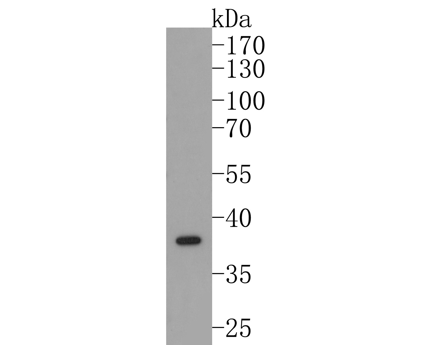 Western blot analysis of ALS2CR1 on HepG2 cell lysates. Proteins were transferred to a PVDF membrane and blocked with 5% BSA in PBS for 1 hour at room temperature. The primary antibody (HA720111, 1/500) was used in 5% BSA at room temperature for 2 hours. Goat Anti-Rabbit IgG - HRP Secondary Antibody (HA1001) at 1:200,000 dilution was used for 1 hour at room temperature.