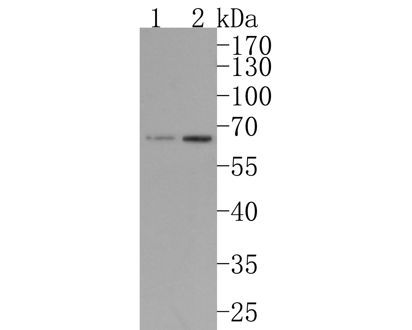 Western blot analysis of IKZF3 on different lysates. Proteins were transferred to a PVDF membrane and blocked with 5% BSA in PBS for 1 hour at room temperature. The primary antibody (HA720110, 1/500) was used in 5% BSA at room temperature for 2 hours. Goat Anti-Rabbit IgG - HRP Secondary Antibody (HA1001) at 1:200,000 dilution was used for 1 hour at room temperature.<br />
Positive control: <br />
Lane 1: K562 cell lysate<br />
Lane 2: Daudi cell lysate