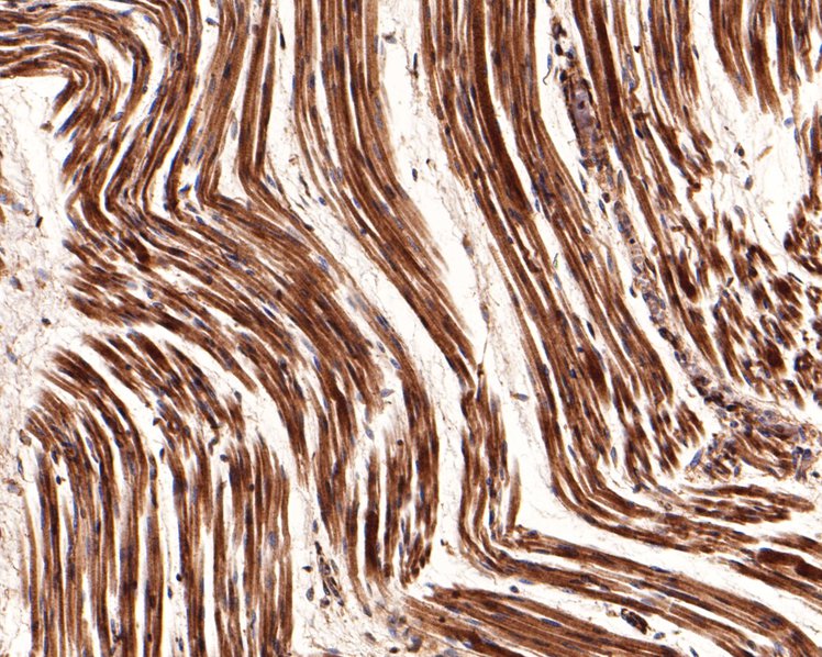 Immunohistochemical analysis of paraffin-embedded human fetal skeletal muscle tissue using anti-CNTFR antibody. The section was pre-treated using heat mediated antigen retrieval with Tris-EDTA buffer (pH 9.0) for 20 minutes.The tissues were blocked in 1% BSA for 30 minutes at room temperature, washed with ddH2O and PBS, and then probed with the primary antibody (HA500506, 1/200) for 30 minutes at room temperature. The detection was performed using an HRP conjugated compact polymer system. DAB was used as the chromogen. Tissues were counterstained with hematoxylin and mounted with DPX.